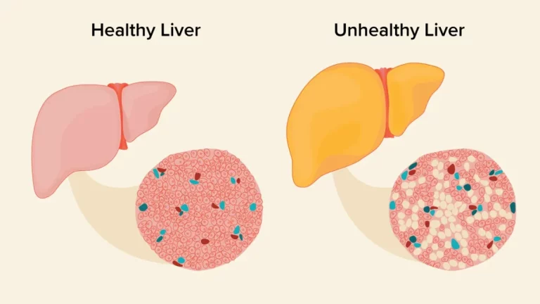 Liver Health Checkup