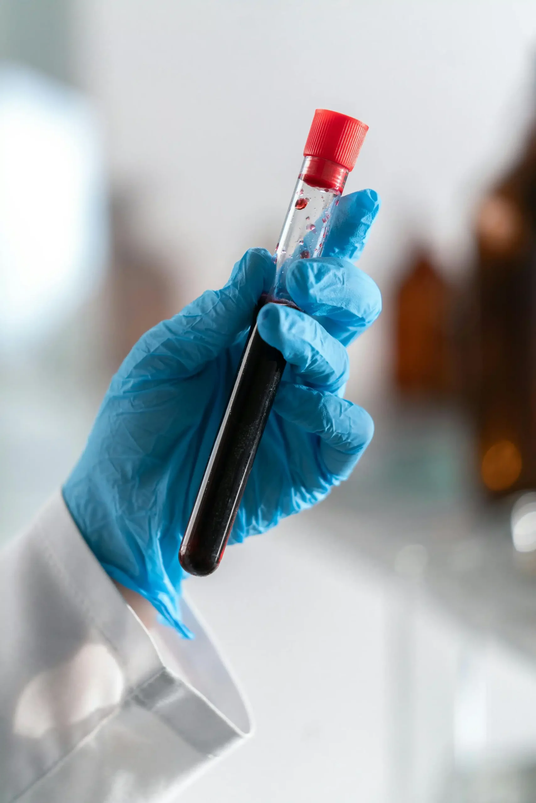 blood test