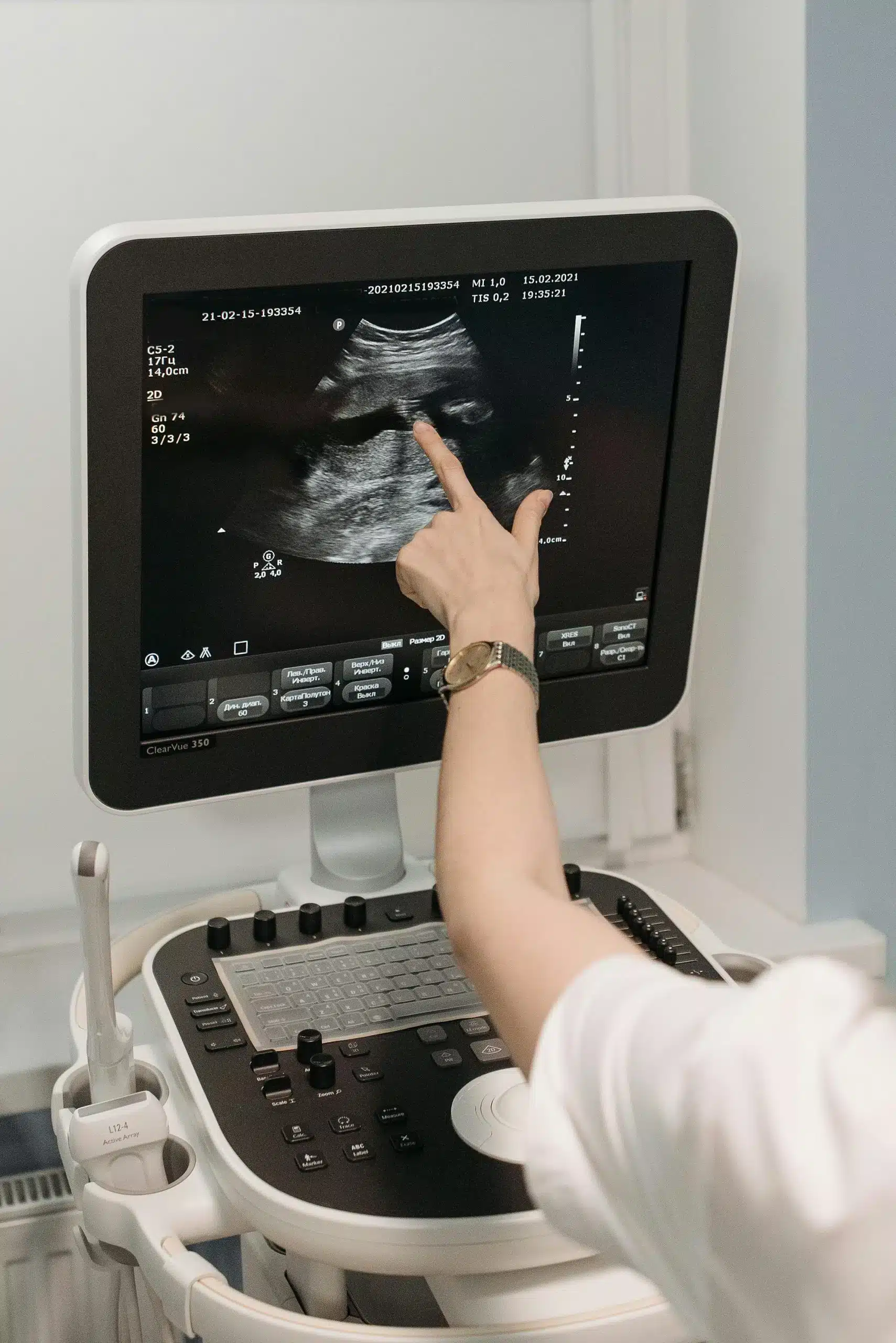 ultrasound scan