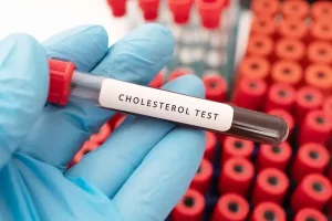 Cholesterol Testing
