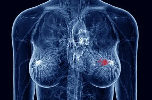 medical imaging of a breast