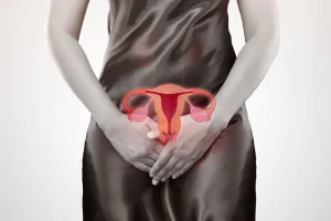 Ovarian cancer