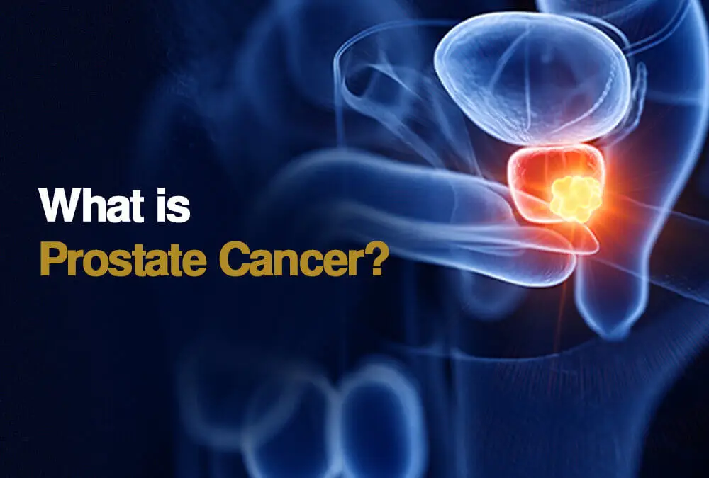 Prostate Cancer
