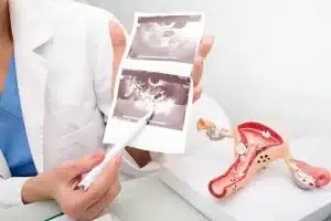 ultrasound for women